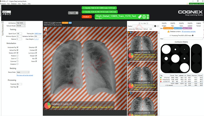 Hình ảnh chụp X-quang phổi 